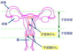 子宮がんについて