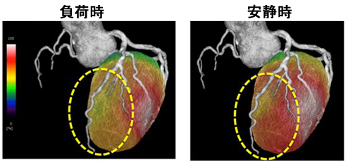 図1 Fusion image（融合画像）