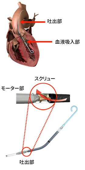 画像提供：日本アビオメッド株式会社