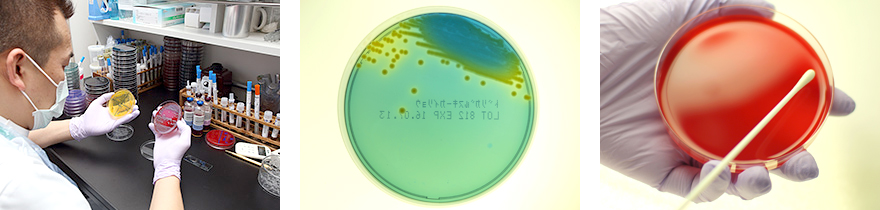 培養・同定検査